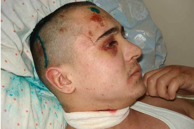 В Башкирии подростков, жестоко избивших и похоронивших таксиста, отпустили домой до суда