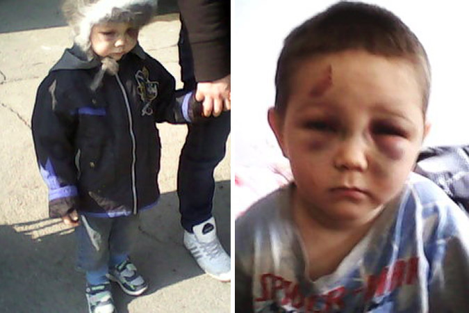 В Башкортостане от рук сожителя матери пострадал ребёнок